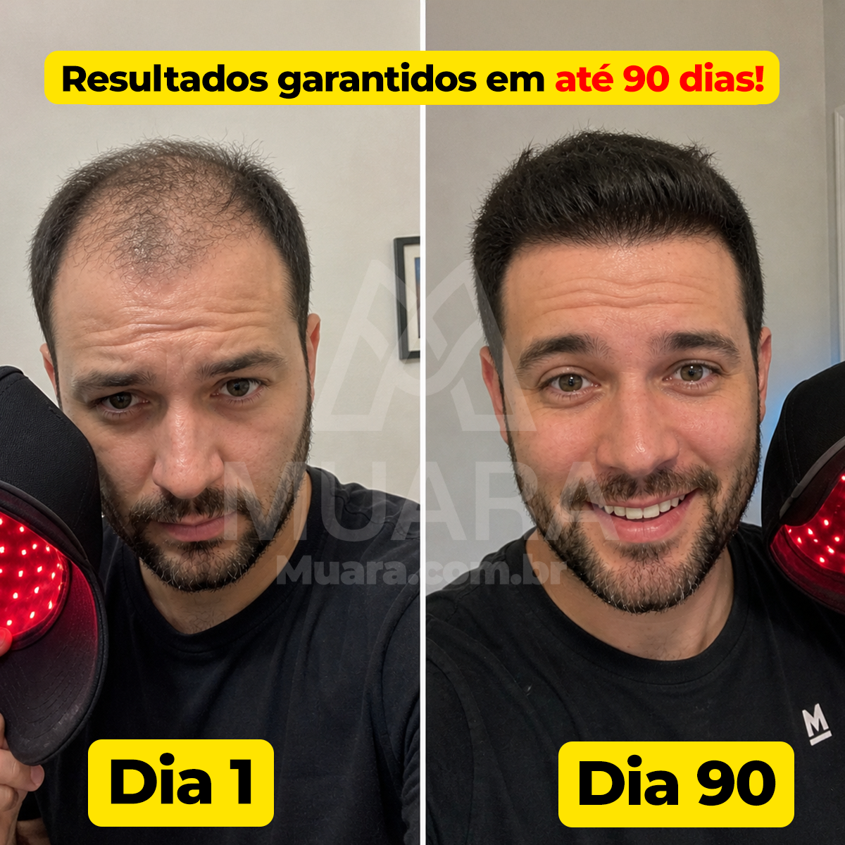 Antes e depois HairLux