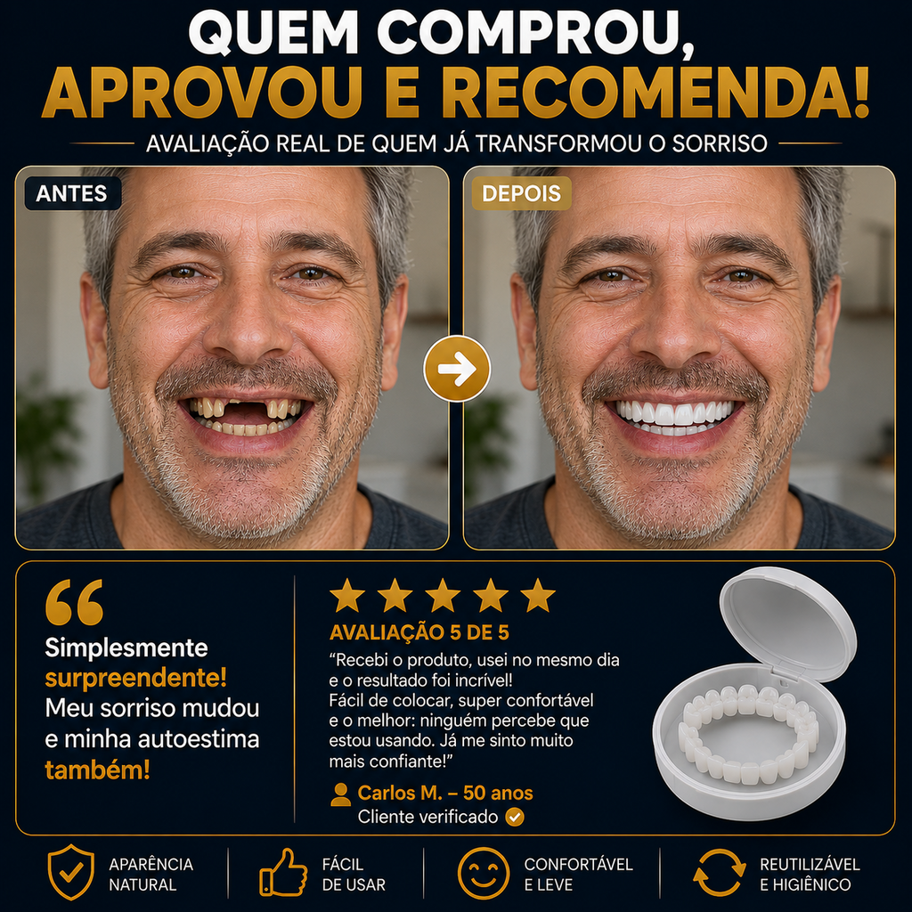 Nature Smile® - Facetas Dentárias Removíveis