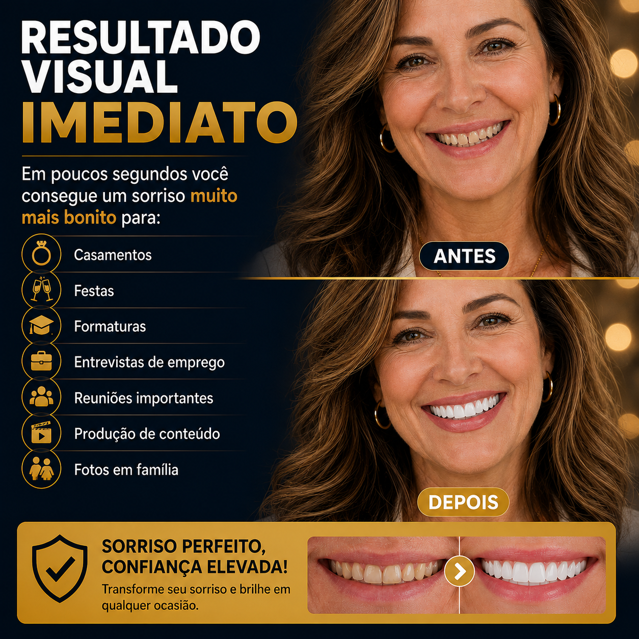 Nature Smile® - Facetas Dentárias Removíveis