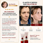 Remove Japan (REJUVELIFT) - Balm Facial Rejuvenescedor Instantâneo Japonês