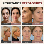 Remove Japan (REJUVELIFT) - Balm Facial Rejuvenescedor Instantâneo Japonês