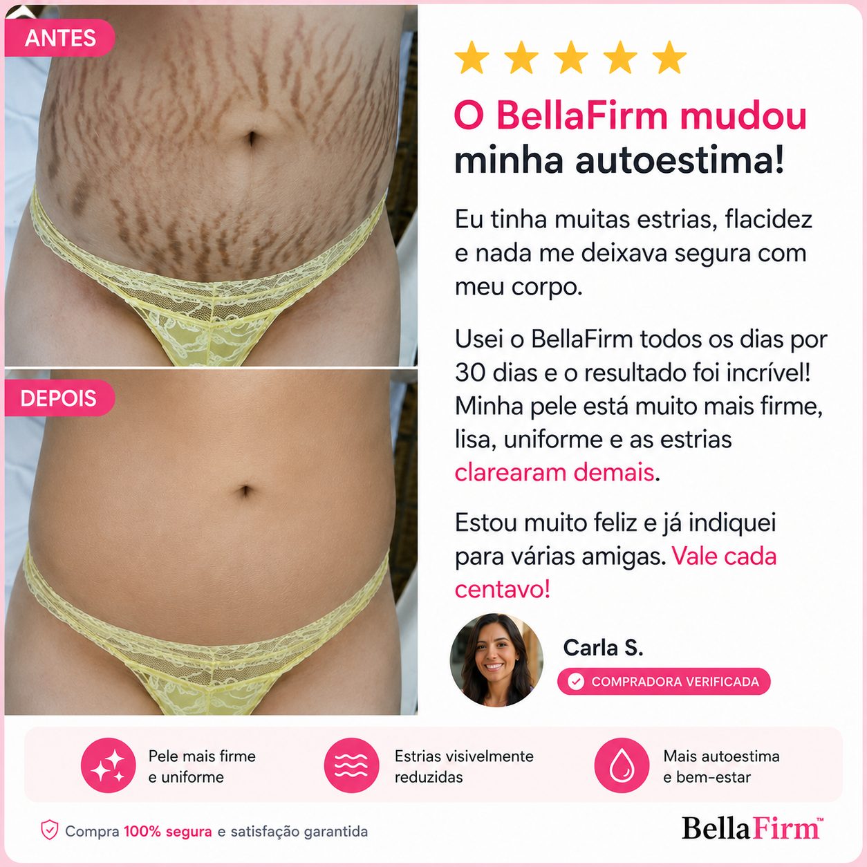 BellaFirm™ Tratamento Intensivo para Estrias e Flacidez