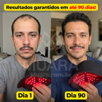 HairLux™ Pro - Tecnologia LED para Crescimento Capilar