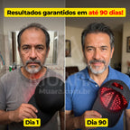 HairLux™ Pro - Tecnologia LED para Crescimento Capilar