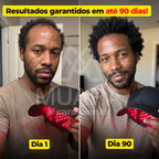 HairLux™ Pro - Tecnologia LED para Crescimento Capilar