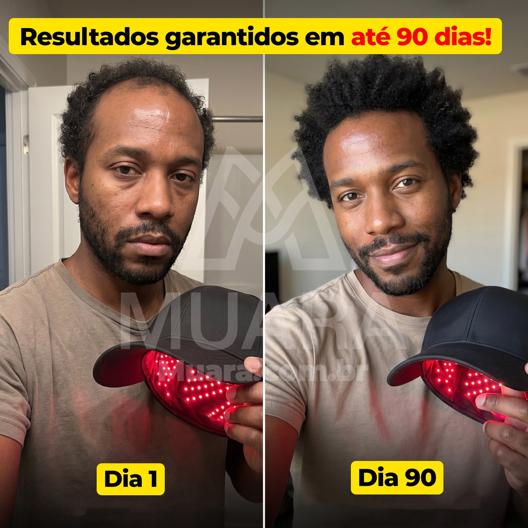 HairLux™ Pro - Tecnologia LED para Crescimento Capilar