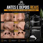 Lanbena Muara™ Black Peel Pro - Máscara de Carvão Ativado para Limpeza Profunda dos Poros